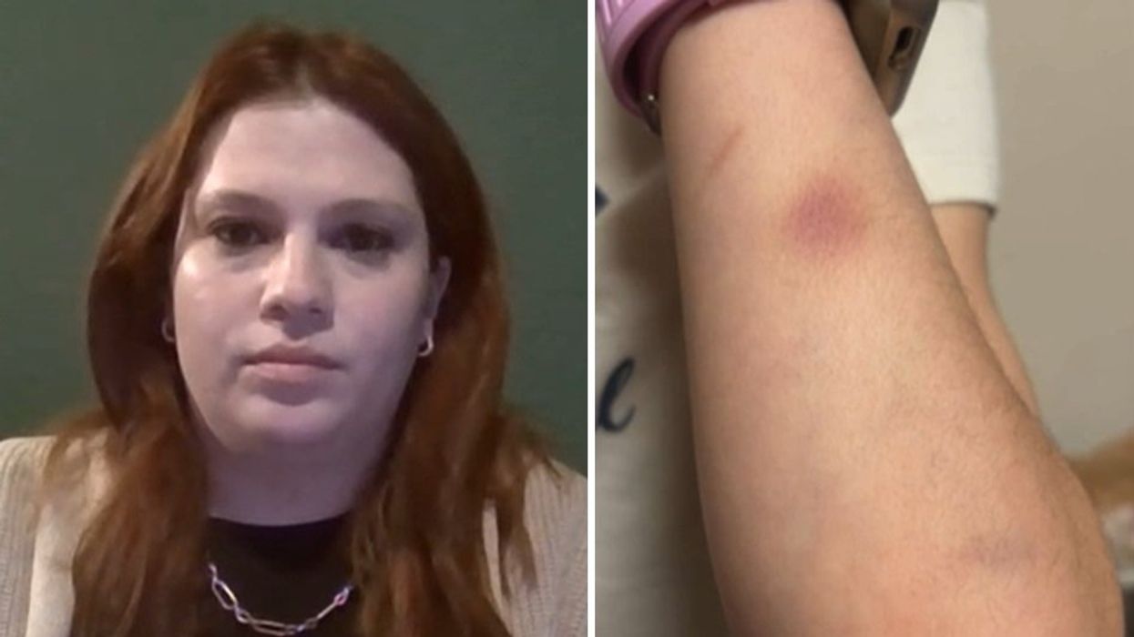 Muslim girls at Minnesota elementary school beat up 9-year-old former friend because she 'wasn't Muslim,' mom says