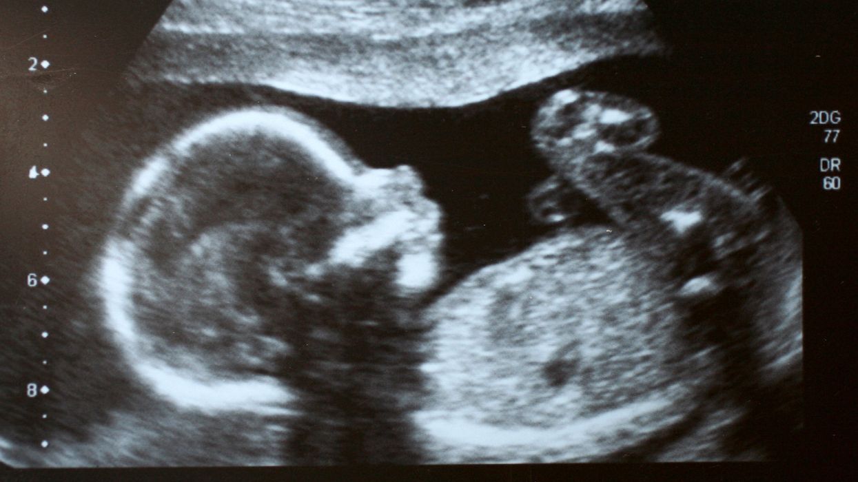 'No uterus, no opinion' is a lie: Why pro-lifers win if they embrace men