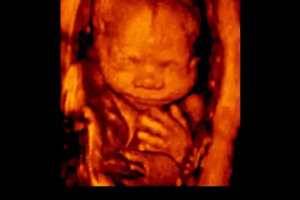 North Dakota Supreme Court overturns lower court judge: Pro-life ban reinstated after leftist attempt to block law