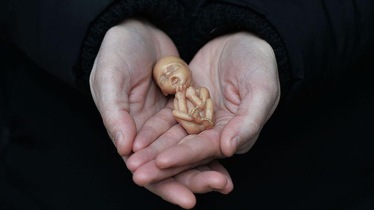 Outraged leftists claim civil rights will be overturned after abortion. But Alito's leaked opinion disproves them.