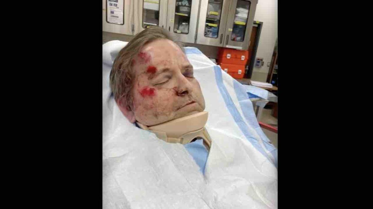 Philly teens beat husband, father so brutally in unprovoked attack that part of his skull has to be removed to relieve pressure on his brain, which was bleeding