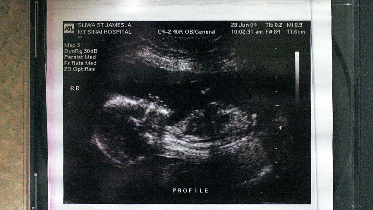 Pro-abortion activists and abortion providers sue to block Texas heartbeat law