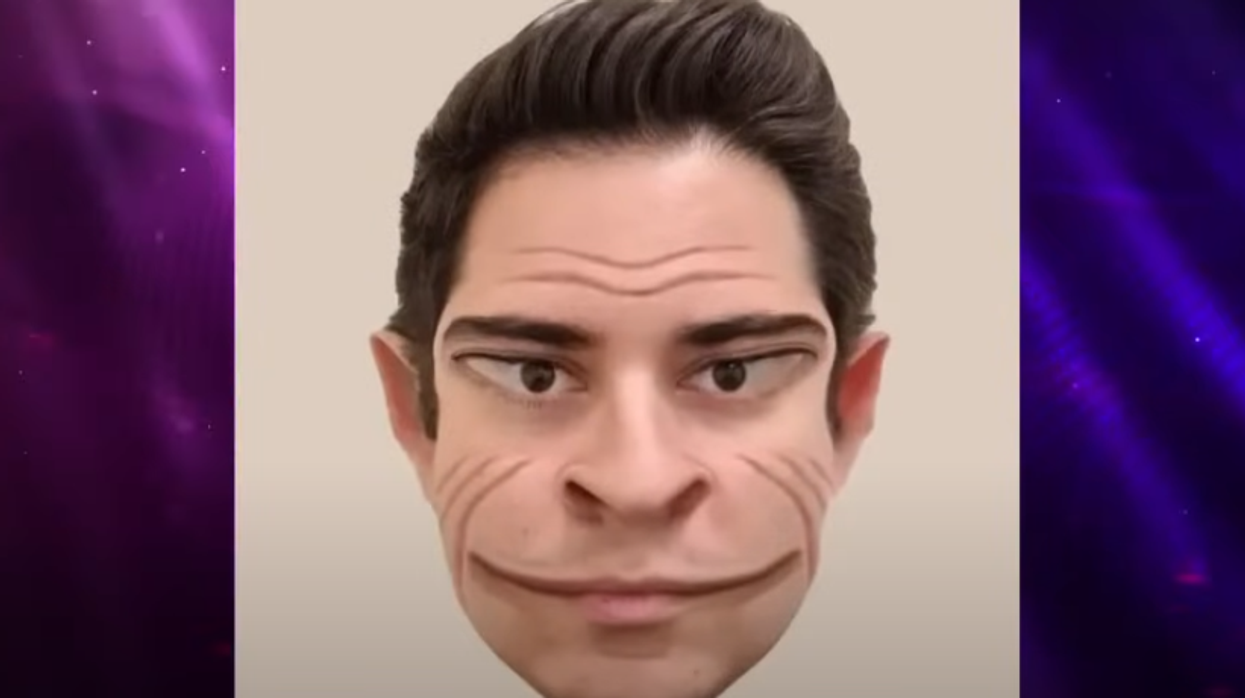 Rare 'visual disorder' caused a 58-year-old man to see distorted ...