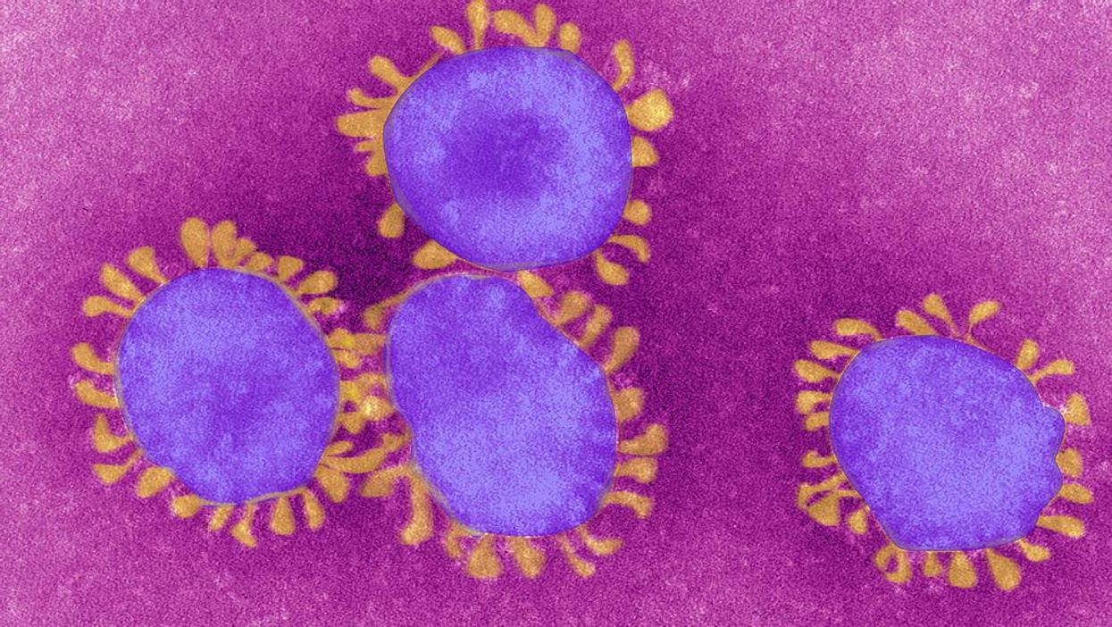 Report: COVID variant from UK 'likely' more lethal, could become dominant strain in America by March