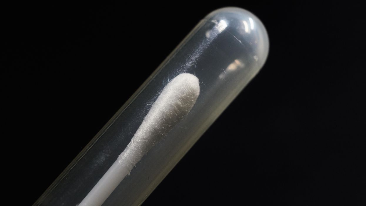 Roughly 200,000 COVID-19 rapid test kits have been recalled due to concerns of abnormally high rates of false positives