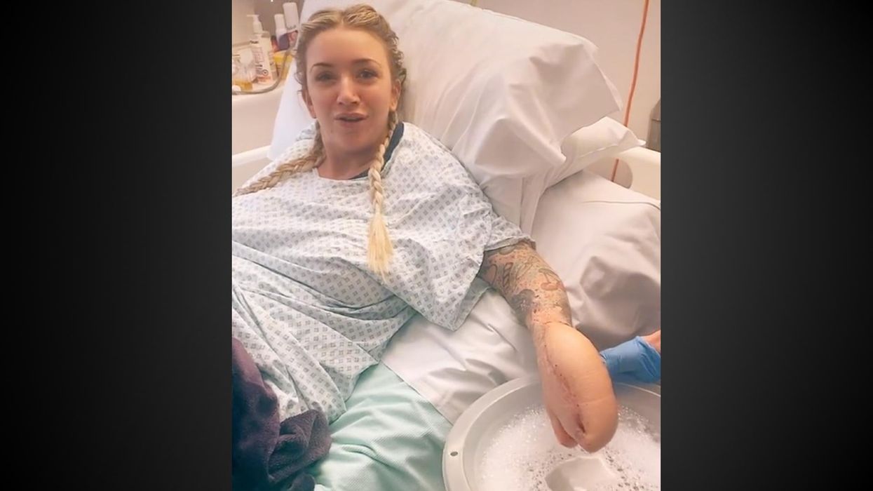 Shocked woman left with 'shark hand' after doctors sew it into her stomach during life-saving surgery