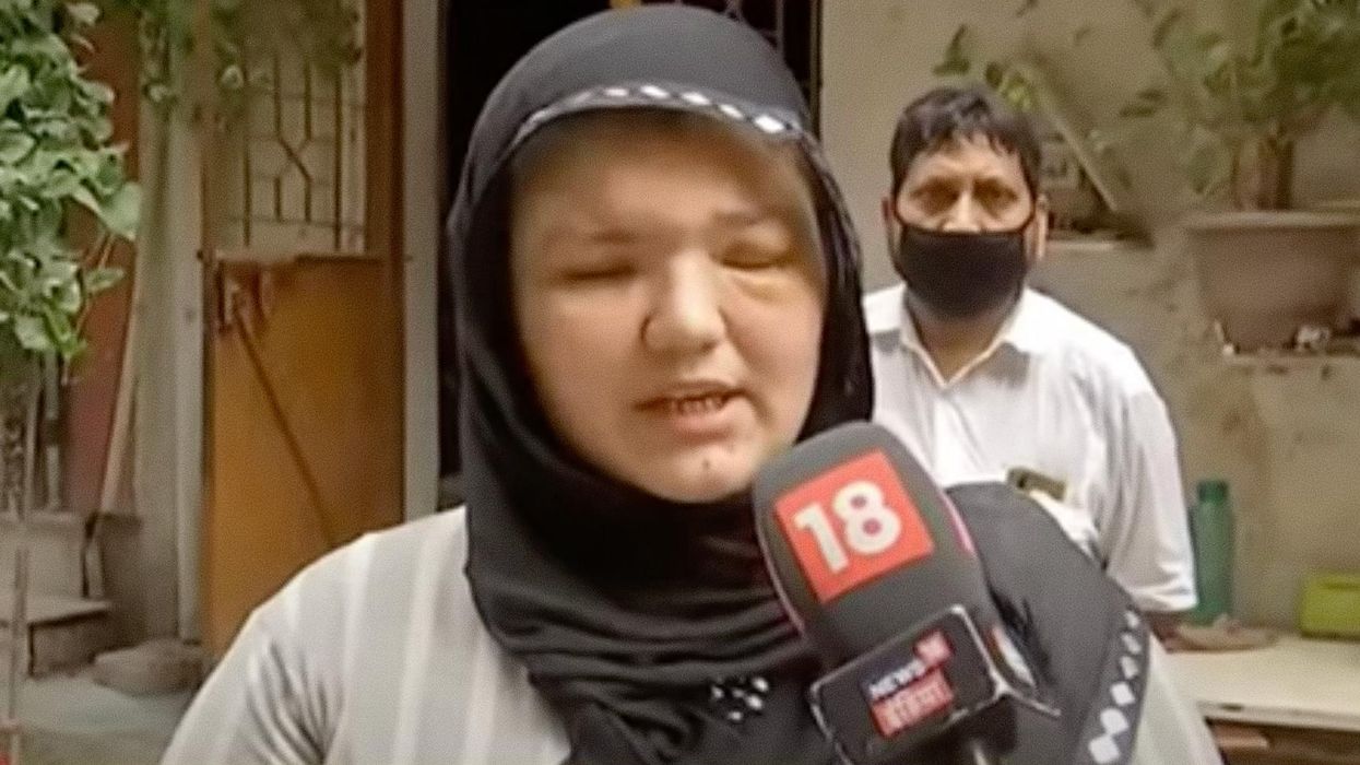 Shot, stabbed Afghan woman whose eyes were knifed out by Taliban says they 'torture us,' feed remains to dogs