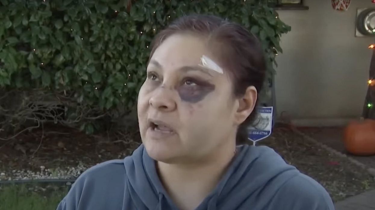 Single mom on way to work fights back amid brutal attack, refuses to give up purse: 'I didn't want him to get away with this'