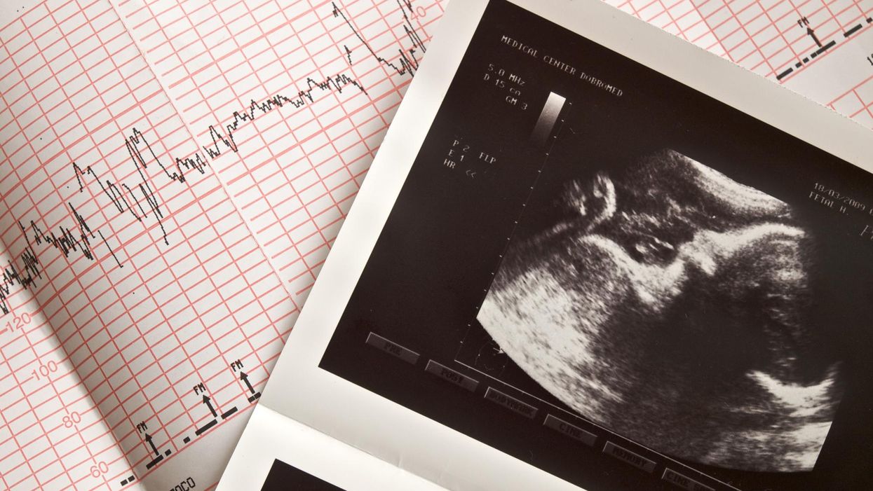 South Carolina Senate advances pro-life heartbeat bill to challenge Roe v. Wade