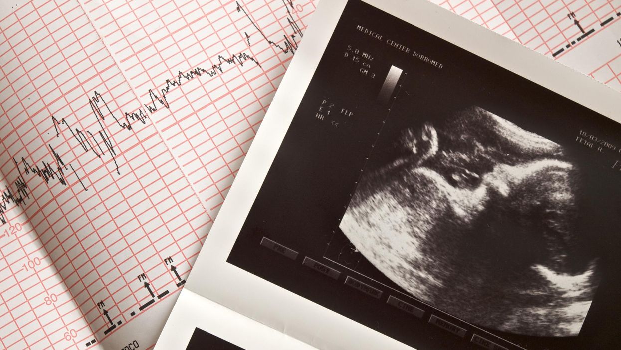 South Carolina Senate advances pro-life heartbeat bill to challenge Roe v. Wade