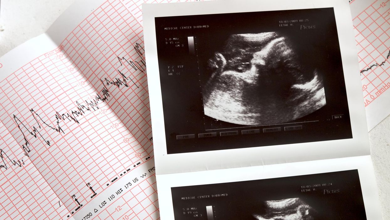 South Dakota Republicans kill fetal heartbeat bill without debate
