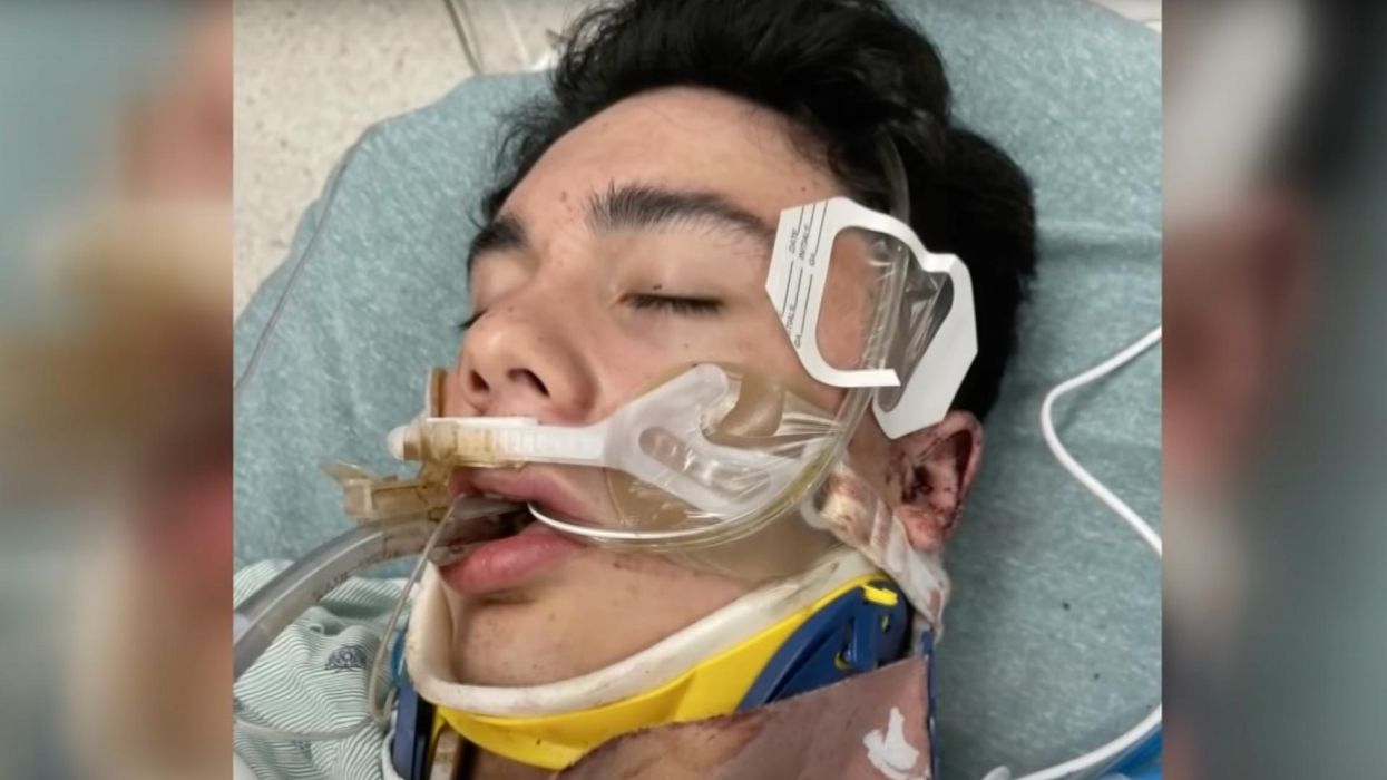 Texas teen brutally beaten, hospitalized in 'heinous act.' Now his family is suing his peers and their parents for $50 million.