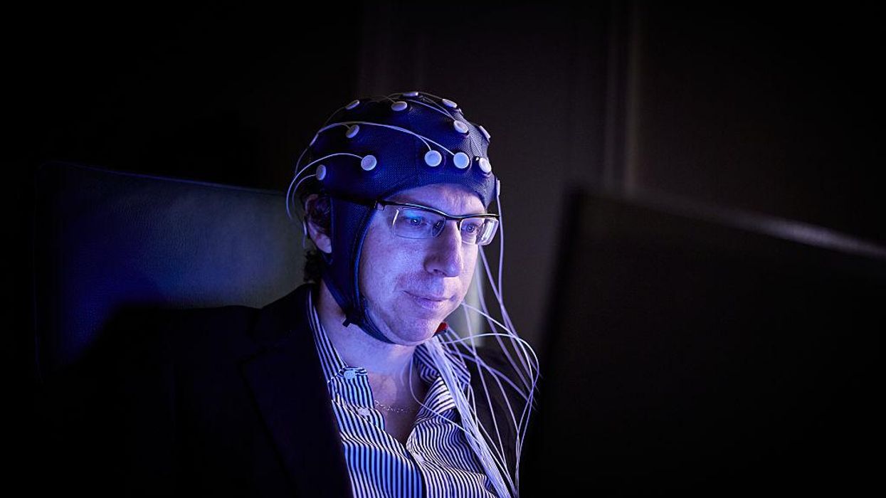 The first commercial brain-computer interface is starting human trials
