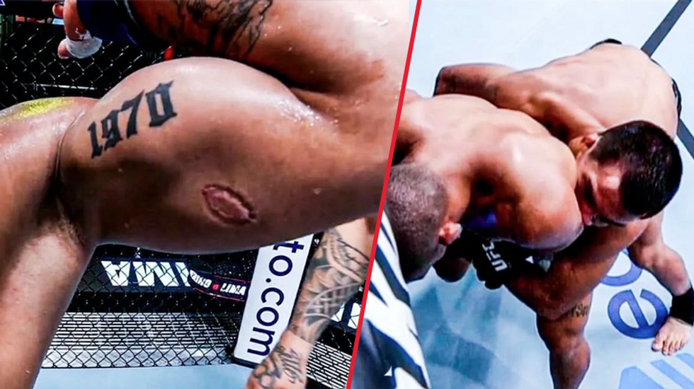 'This is awesome!' UFC President Dana White doubles bonus for fighter who was bitten after seeing how he celebrated the win