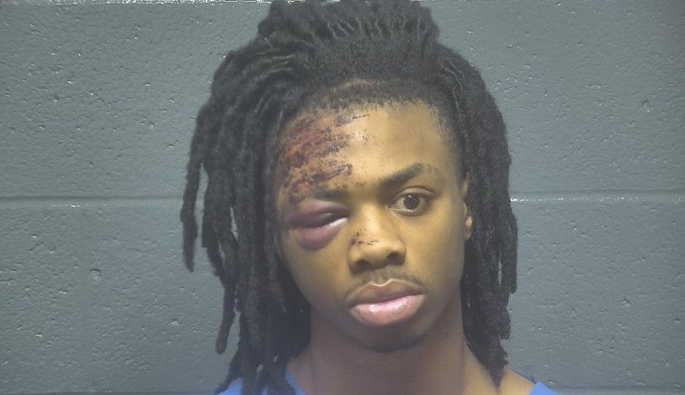 Thug allegedly robs woman at gunpoint for pair of shoes. The whole thing ends rather painfully for him.