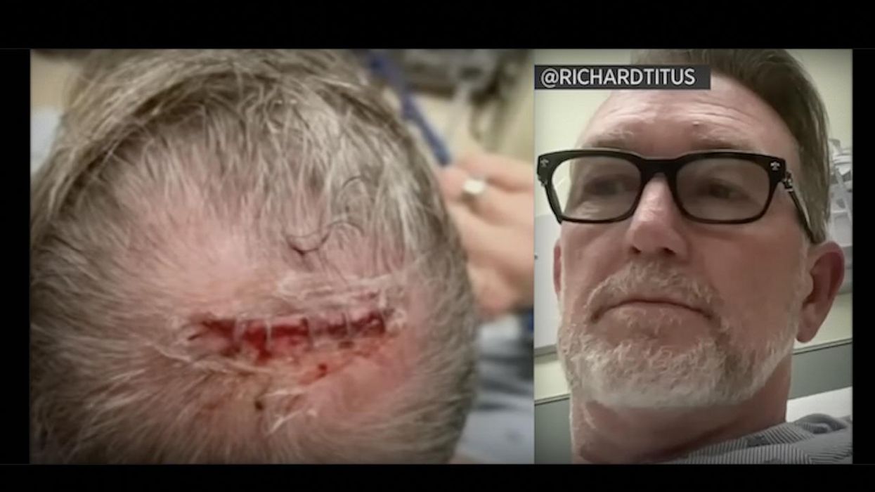 Thugs bash big man in back of head with 'metal' object on San Francisco street, knock him down. But he gets up, throws a punch — and the thugs turn into sissies.