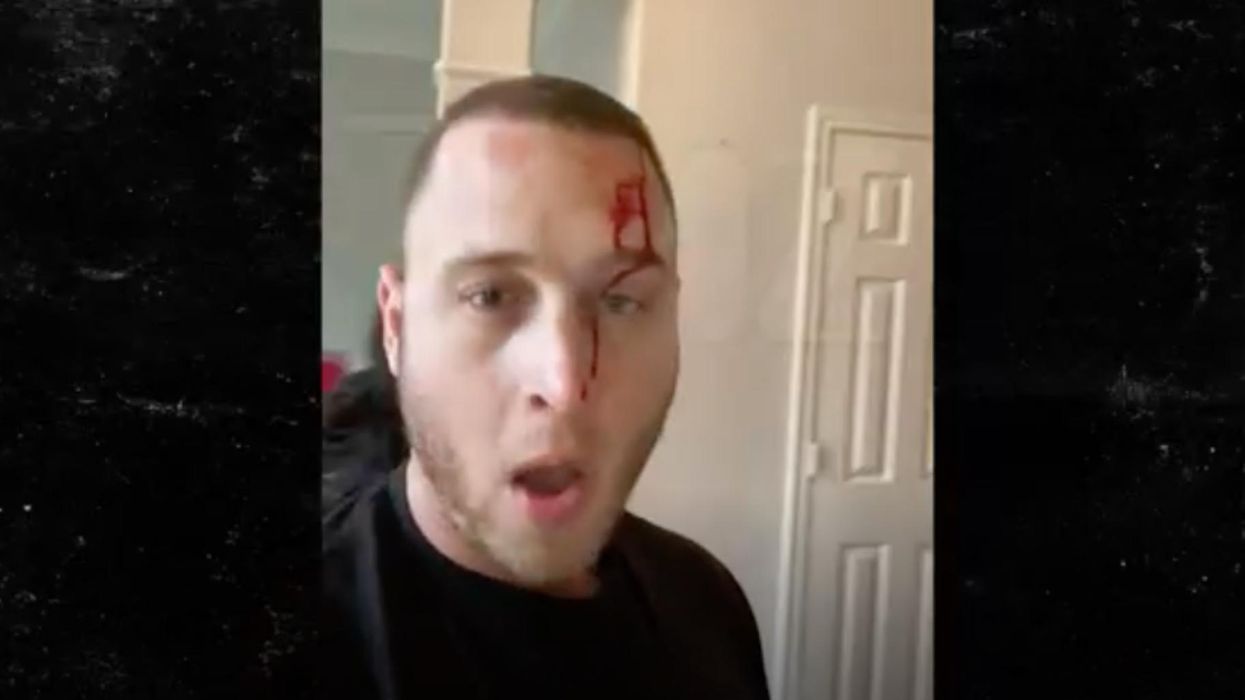 Tom Hanks’ son caught on video in bloody brawl with ex-girlfriend as allegations of violence explode