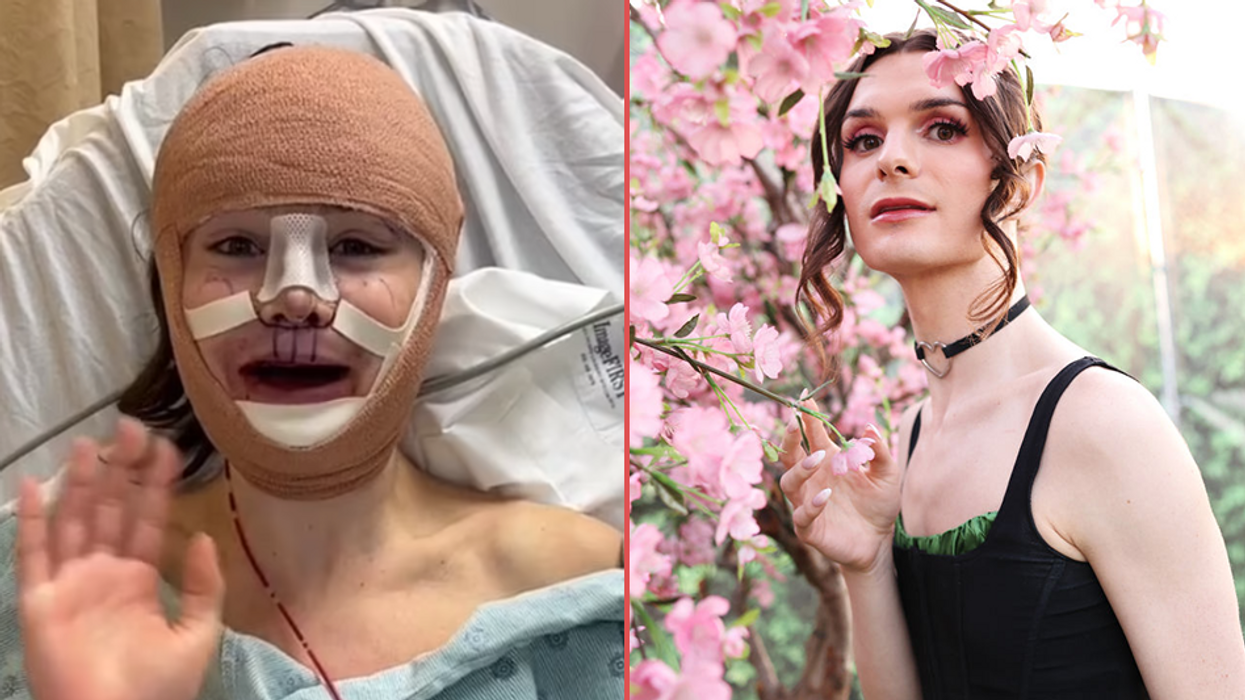 Trans influencer, White House guest Dylan Mulvaney gets radical 'feminization surgery'