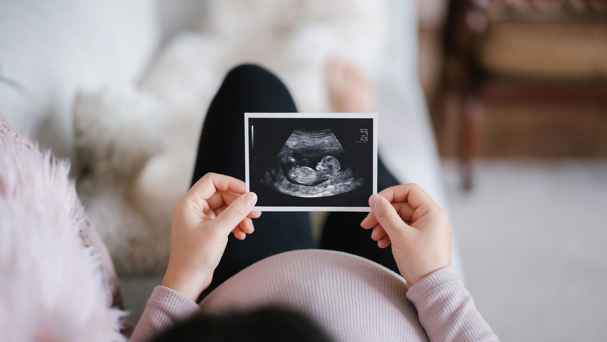 US abortions increase: 1 out of 5 preborn babies were killed in 2020