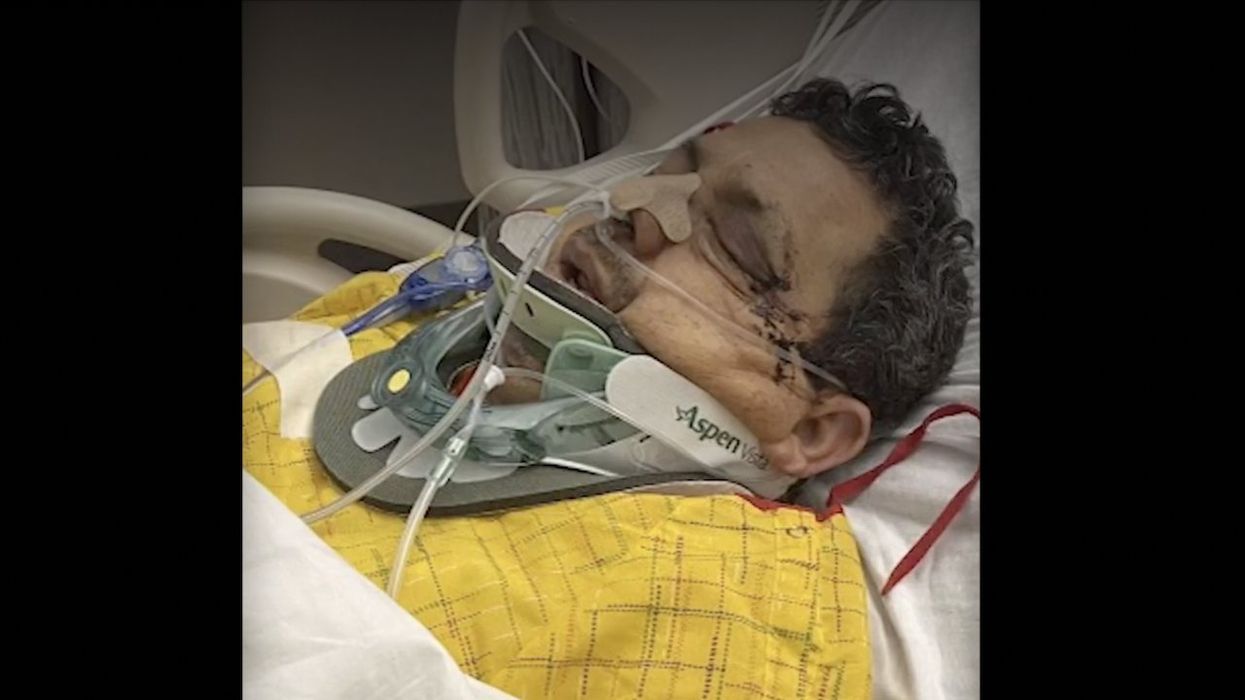 Video: Thug sucker-punches 68-year-old market worker in face, knocks him out. Victim suffers fractured skull, brain bleeding.