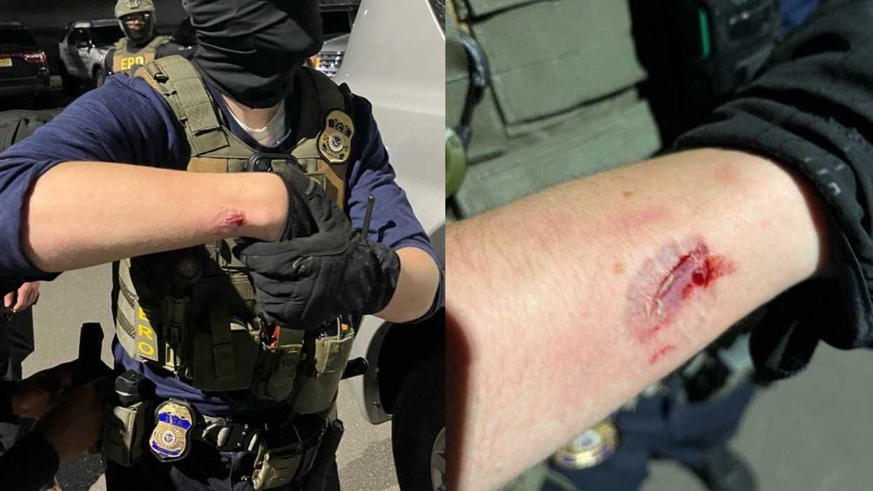 'Violent agitator' savagely bit ICE agent during riots in New Jersey, says DHS
