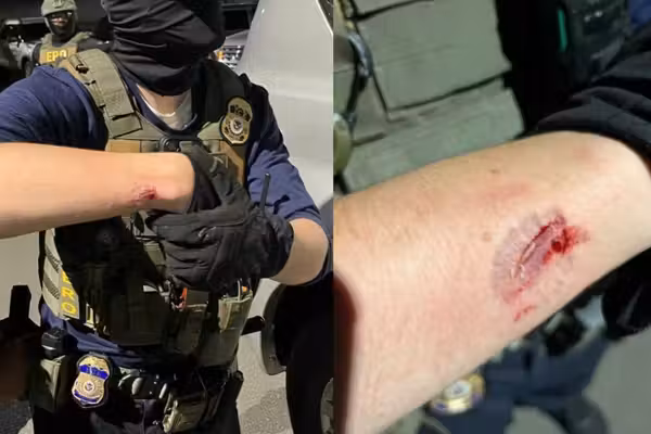 'Violent agitator' savagely bit ICE agent during riots in New Jersey, says DHS