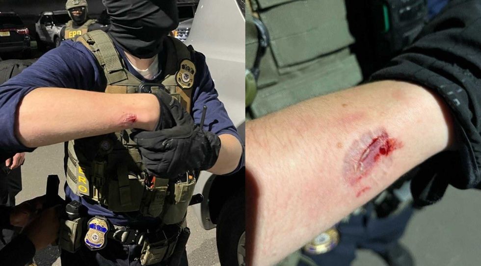 'Violent agitator' savagely bit ICE agent during riots in New Jersey, says DHS