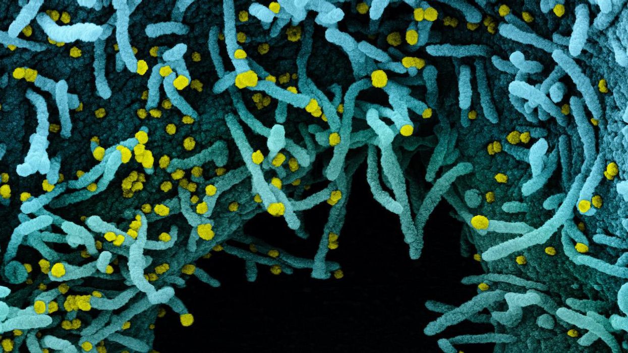WHO adds new COVID variant — 'Mu' — to its watchlist, warns that it could evade vaccines