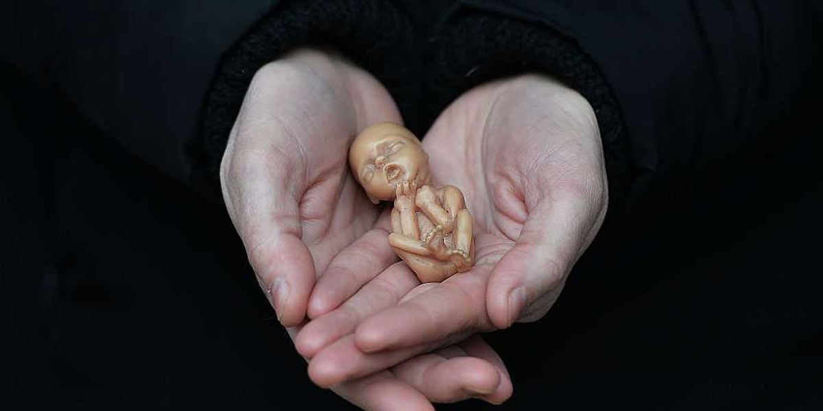 Why the pro-life movement fails without a Christian worldview