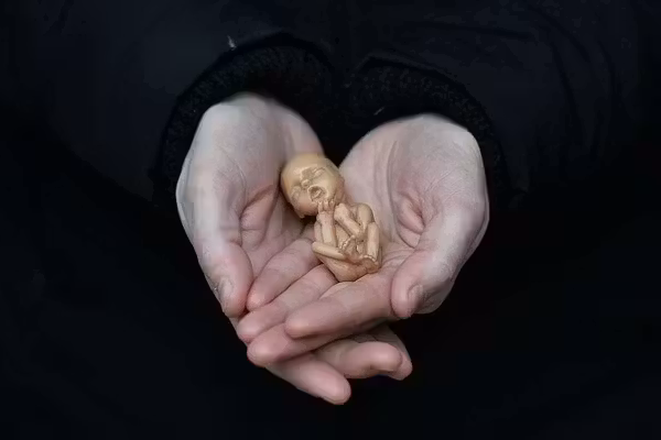 Why the pro-life movement fails without a Christian worldview