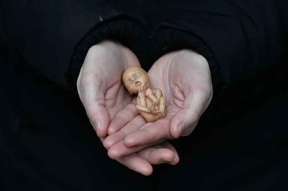 Why the pro-life movement fails without a Christian worldview