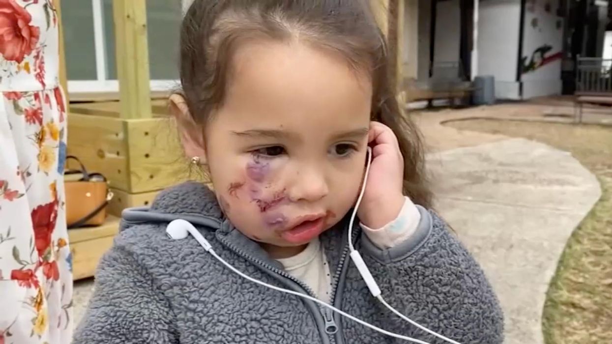 Woman’s service dog reportedly attacks toddler. Child's family claims she blamed the child and fled the scene.