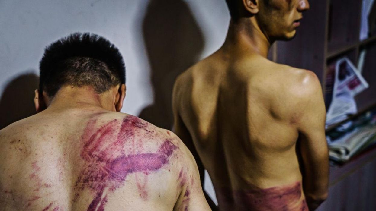 'You're lucky you weren't beheaded': Afghan journalists beaten, kicked, crushed by Taliban for covering women's rights protest thought they were going to die